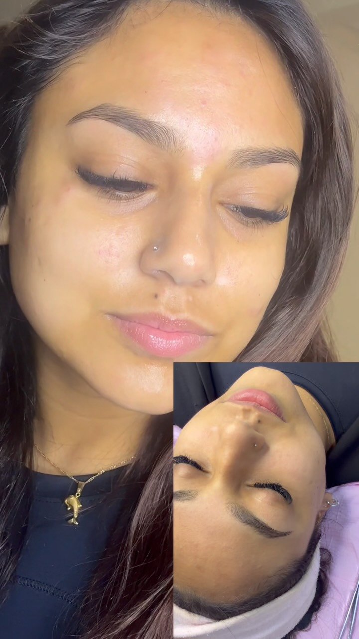 Clienta después de una higiene facial